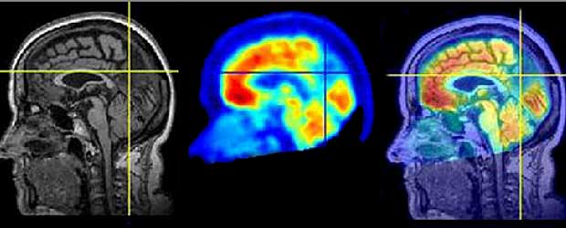 ¿Puede la neurociencia predecir las conductas delictivas?